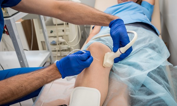 What Treatments Work for Venous Ulcers?